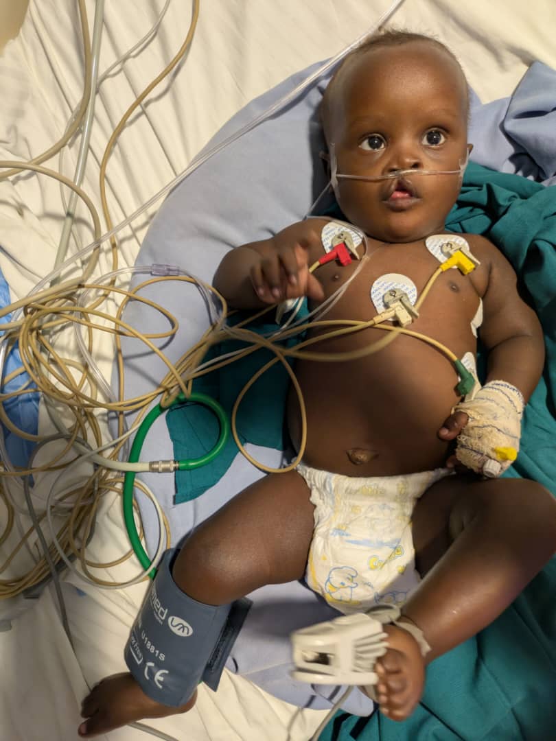 A young child receiving medical monitoring during care.